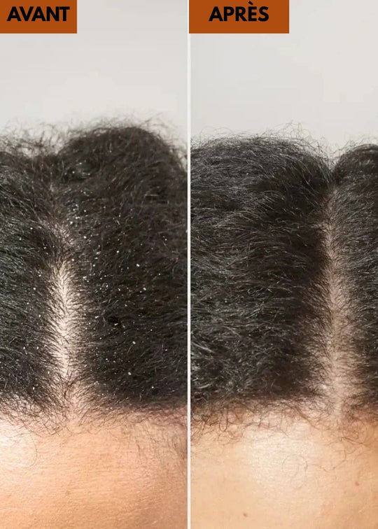 Peigne détoxifiant pour cuir chevelu